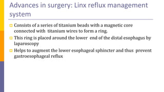 Linx Radiology GERD Management recent advances.pptx