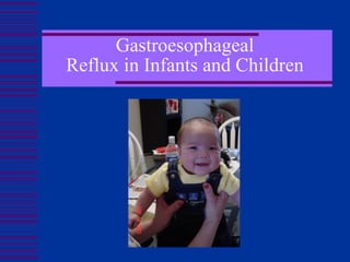 Gastroesophageal
Reflux in Infants and Children

         Melissa Velez
 