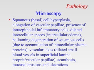 Pathology
Microscopy
• Squamous (basal) cell hyperplasia,
elongation of vascular papillae, presence of
intraepithelial inflammatory cells, dilated
intercellular spaces (intercellular edema),
ballooning degeneration of squamous cells
(due to accumulation of intracellular plasma
proteins), vascular lakes (dilated small
blood vessels in superficial lamina
propria/vascular papillae), acanthosis,
mucosal erosions and ulcerations
 