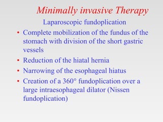 Minimally invasive Therapy
Laparoscopic fundoplication
• Complete mobilization of the fundus of the
stomach with division of the short gastric
vessels
• Reduction of the hiatal hernia
• Narrowing of the esophageal hiatus
• Creation of a 360° fundoplication over a
large intraesophageal dilator (Nissen
fundoplication)
 