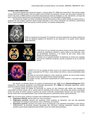 Arlindo Ugulino Netto; Luiz Gustavo Barros; Yuri Leite Eloy – GERIATRIA – MEDICINA P8 – 2011.1
295
EXAMES COMPLEMENTARES
No que diz respeito aos exames de imagem, a maioria deles (TC, RNM) são inespecíficos. Tais exames podem
mostrar sinais de atrofia cerebral, mas que podem ocorrer também em pacientes normais, que não portam a doença. Na
maioria das vezes, a RNM evidencia uma atrofia hipocampal que pode ser fisiológica ou não. Obviamente, ao longo dos
anos, a atrofia cortical determinará uma diminuição do hipocampo, com hidrocefalia compensatória.
Os exames de imagem se tornam importantes quando associamos a eles os dados obtidos da história clínica: a
presença de uma imagem sugerindo atrofia cortical associada a uma clínica compatível com demência, praticamente
fecha a nossa hipótese. Ainda mais quando a atrofia aumenta, em exames subsequentes.
RNM em sequência de aquisição T2 mostrando uma área inespecífica de atrofia cerebral que
pode ser bastante sugestivo de Alzheimer ao ser associado a um quadro clínico clássico
desta demência.
O PET-Scan (TC por emissão de prótons) fornece ótimos dados referentes
a análise do metabolismo cerebral e, quanto melhor a sua resolução, maior
sua sensibilidade. Entretanto, é um exame de alto custo, sendo mais
utilizado em centros de pesquisa.
O cérebro de um paciente portador de Alzheimer se mostra com captação
diminuída do metabólito da glicose, quando comparado ao de um paciente
normal.
O SPECT-TC (TC por emissão de fóton único) é um exame mais acessível atualmente,
quando comparado ao PET-Scan, muito embora não tenha a mesma sensibilidade deste
exame.
Ele pode ser útil quando avaliamos o fluxo sanguíneo cerebral, em que se pode mostrar
diminuição do fluxo nas regiões frontal e têmporo-parietais.
Na imagem ao lado, observamos hipoperfusão em córtex temporal, o que pode sugerir a
demência.
Em resumo, os achados típicos nos exames complementares são: LCR normal; Eletroencefalograma (EEG)
inespecífico, mas podendo apresentar uma lentificação generalizada; TC e RNM sem alterações específicas, porém,
podemos evidenciar atrofia cerebral em cortes coronais.
A principal função da análise da diminuição do volume do lobo temporal está restrita nas ocasiões de
precocidade de atrofia cortical, isto é, quando esta se manifesta ainda durante a vida adulta. Isso porque a senilidade
evolui com graus de atrofia cortical e aumento do volume ventricular compensatório, fazendo com que estes testes
percam ainda mais a sua especificidade. Caso a atrofia seja precoce, poderíamos indicar quadro demencial.
OBS
1
: De uma forma geral, podemos considerar três modalidades de diagnóstico de Alzheimer:
 Diagnóstico definido: apenas obtido por meio da autópsia.
 Diagnóstico provável: paciente que apresenta sinais evidentes de Alzheimer, mas que não apresenta
associação com qualquer outra doença, como o Parkinson, por exemplo.
 Diagnóstico possível: paciente com quadro clínico de Alzheimer e que apresenta associação a outra doença.
Classicamente, as principais doenças associadas são: Parkinson, doenças vasculares cerebrais prévias,
paralisia supra-nuclear progressiva (que também cursa com sinais extra-piramidais).
 