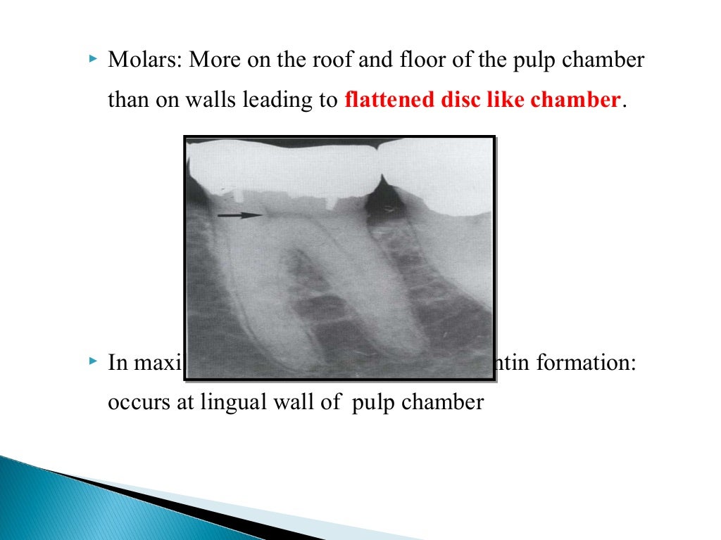 Geriatric endodontics by Dr. JAGADEESH KODITYALA