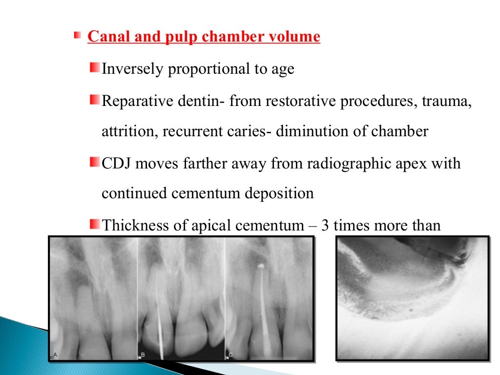 Geriatric endodontics by Dr. JAGADEESH KODITYALA