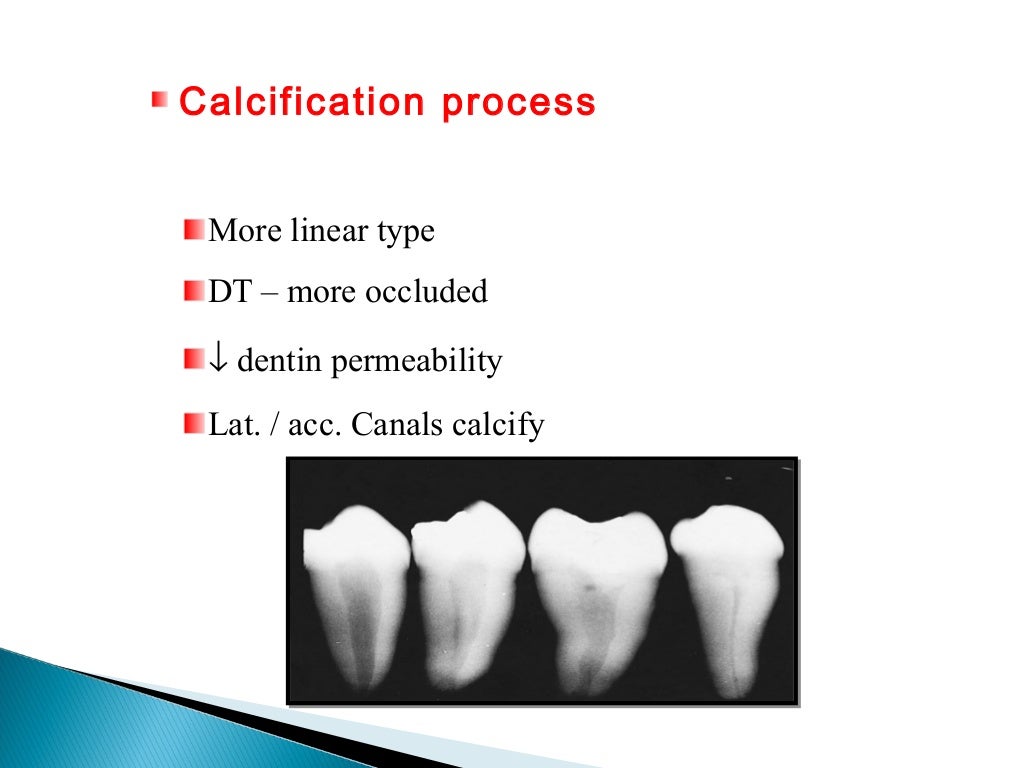 Geriatric endodontics by Dr. JAGADEESH KODITYALA
