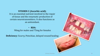 VITAMIN C (Ascorbic acid):
It is an essential nutrient involved in the repair
of tissue and the enzymatic production of
certain neurotransmitters. It also functions as
an antioxidant.
• RDA:
90mg for males and 75mg for females
Deficiency: Scurvy, Petechiae, delayed wound healing
Geriatric Nutrition 20
 