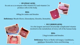• B12 (RIBOFLAVIN)
It is the largest and most structurally complicated vitamin
involved in the metabolism of every cell of the human body.
RDA:
2.4µg in males and females.
Deficiency: Fiery or Beefy red tongue, Candidiasis,
Aphthous Stomatitis, Intra-oral Burning.
• B9 (FOLIC ACID)
Its acts as a co-enzyme with vitamin b12 and vitamin C to
produce cells in the body.
RDA:
400µg for males and females
Deficiency: Mouth Ulcers, Glossodynia, Glossitis, Stomatitis.
Geriatric Nutrition 18
 
