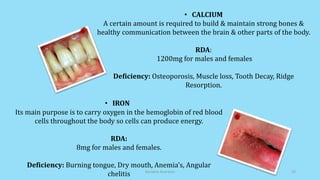 • CALCIUM
A certain amount is required to build & maintain strong bones &
healthy communication between the brain & other parts of the body.
RDA:
1200mg for males and females
Deficiency: Osteoporosis, Muscle loss, Tooth Decay, Ridge
Resorption.
• IRON
Its main purpose is to carry oxygen in the hemoglobin of red blood
cells throughout the body so cells can produce energy.
RDA:
8mg for males and females.
Deficiency: Burning tongue, Dry mouth, Anemia’s, Angular
chelitis Geriatric Nutrition 22
 