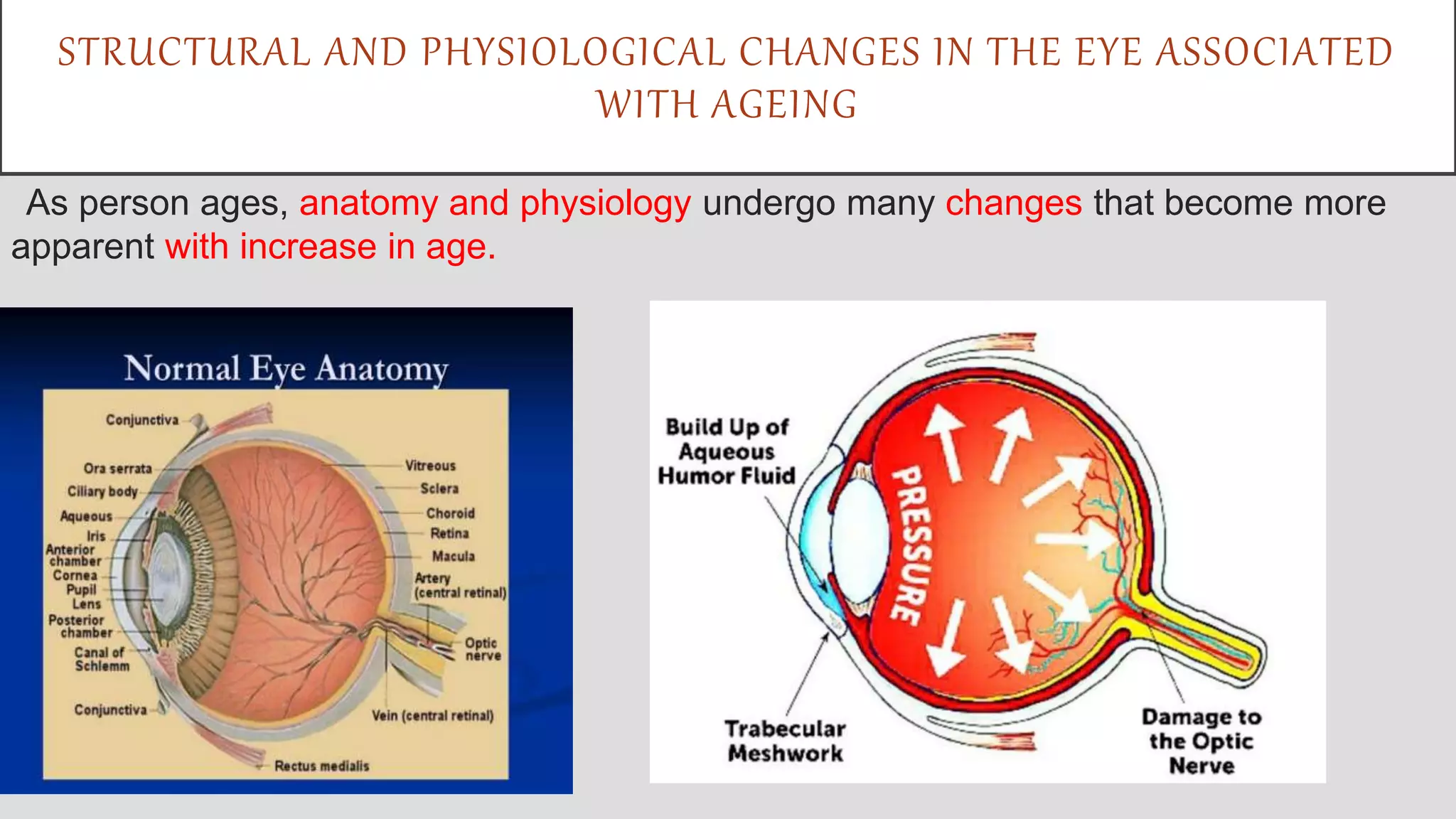 Structural Changes and Physiological Changes in the Eye Associated With ...
