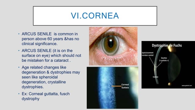 Structural Changes and Physiological Changes in the Eye Associated With ...