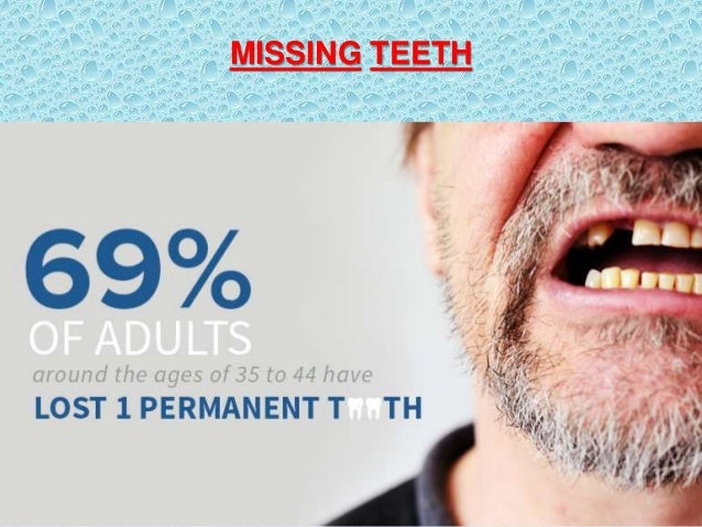 Teeth Problems in old age