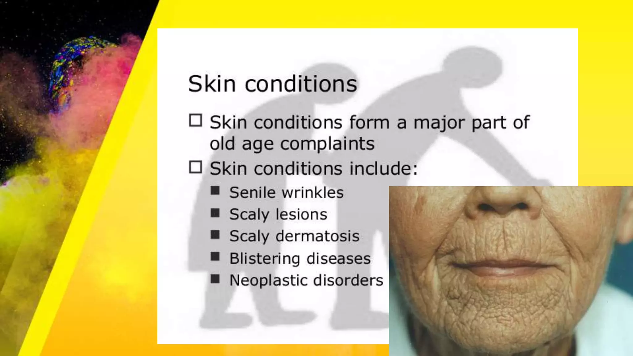 Age Related Problems / Geriatric problems