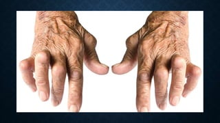 Geriatric radiography.pptx Geriatric radiography.pptxGeriatric ...