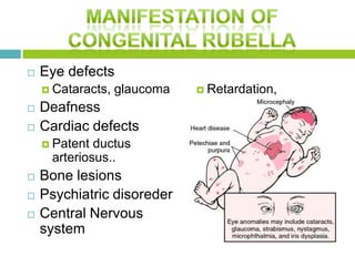  Eye defects
 Cataracts, glaucoma
 Deafness
 Cardiac defects
 Patent ductus
arteriosus..
 Bone lesions
 Psychiatric disoreder
 Central Nervous
system
 Retardation,
microcephaly
 