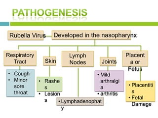 Rubella Virus Developed in the nasopharynx
Respiratory
Tract Skin
Lymph
Nodes Joints
Placent
a or
Fetus
• Cough
• Minor
sore
throat
• Rashe
s
• Lesion
s • Lymphadenophat
y
• Mild
arthralgi
a
• arthritis
• Placentiti
s
• Fetal
Damage
 