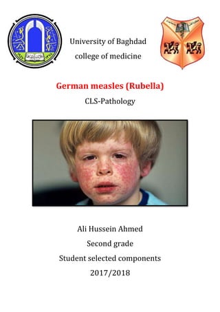 University of Baghdad
college of medicine
German measles (Rubella)
CLS-Pathology
Ali Hussein Ahmed
Second grade
Student selected components
2017/2018
 