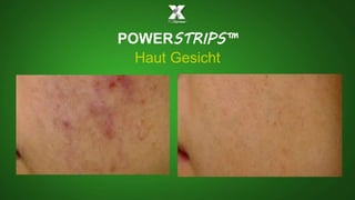 POWERSTRIPS™ 
Haut Gesicht 
 