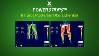 POWERSTRIPS™ 
Infrarot Posterior Oberschenkel 
 