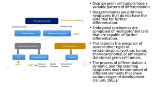 • Ovarian germ cell tumors have a
variable pattern of differentiation.
• Dysgerminomas are primitive
neoplasms that do not have the
potential for further
differentiation.
• Embryonal carcinomas are
composed of multipotential cells
that are capable of further
differentiation.
• This lesion is the precursor of
several other types of
extraembryonic (yolk sac tumor,
choriocarcinoma) or embryonic
(teratoma) germ cell tumors.
• The process of differentiation is
dynamic, and the resulting
neoplasms may be composed of
different elements that show
various stages of development
(Teilum, 1965).
 