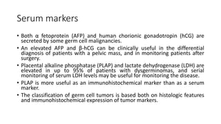 Serum markers
• Both α fetoprotein (AFP) and human chorionic gonadotropin (hCG) are
secreted by some germ cell malignancies.
• An elevated AFP and β-hCG can be clinically useful in the differential
diagnosis of patients with a pelvic mass, and in monitoring patients after
surgery.
• Placental alkaline phosphatase (PLAP) and lactate dehydrogenase (LDH) are
elevated in up to 95% of patients with dysgerminomas, and serial
monitoring of serum LDH levels may be useful for monitoring the disease.
• PLAP is more useful as an immunohistochemical marker than as a serum
marker.
• The classification of germ cell tumors is based both on histologic features
and immunohistochemical expression of tumor markers.
 