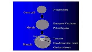 Germ cell tumor ovary.pptx