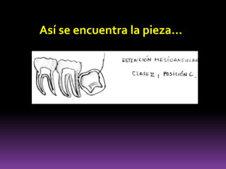 Así se encuentra la pieza…
 