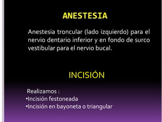 Anestesia troncular (lado izquierdo) para el
nervio dentario inferior y en fondo de surco
vestibular para el nervio bucal.
INCISIÓN
Realizamos :
•Incisión festoneada
•Incisión en bayoneta o triangular
 