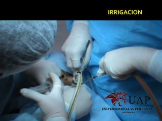 IRRIGACION
 