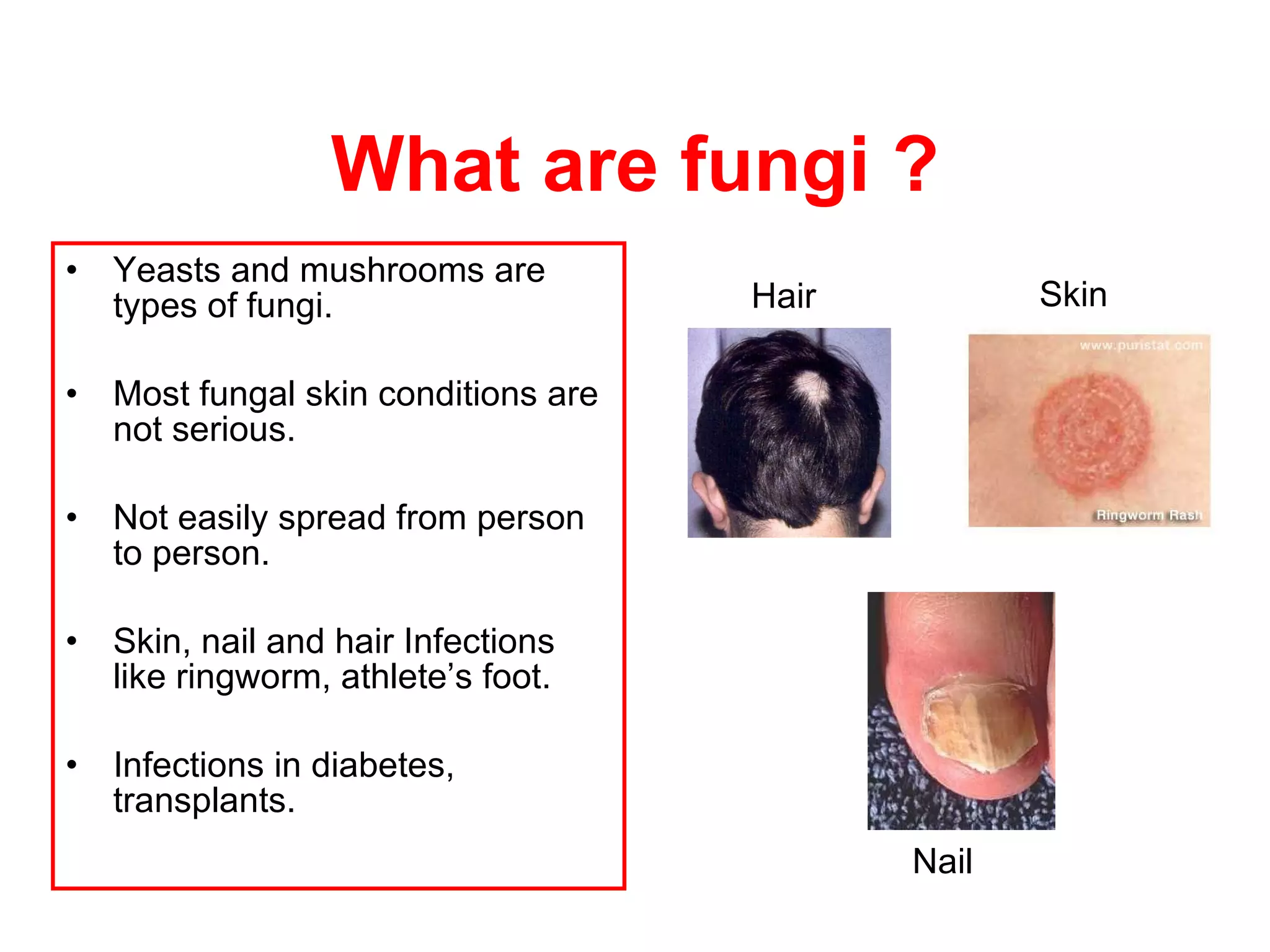 What are fungi ? Y easts and mushrooms are types of fungi . Most fungal skin conditions are not serious .   N ot easily spread from person to person.  Skin, nail and hair Infections like ringworm, athlete’s foot. Infections in diabetes, transplants. Hair Skin Nail 