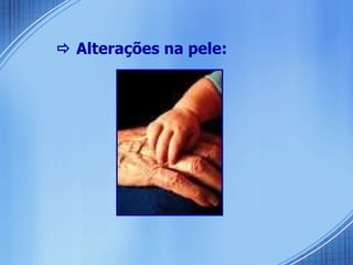    Alterações na pele: 