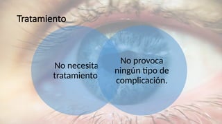 Tratamiento
No necesita
tratamiento
No provoca
ningún tipo de
complicación.
 