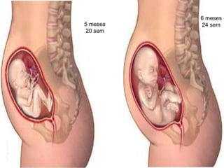 6 meses
24 sem
5 meses
20 sem
 