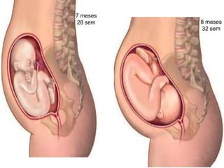 7 meses
28 sem 8 meses
32 sem
 