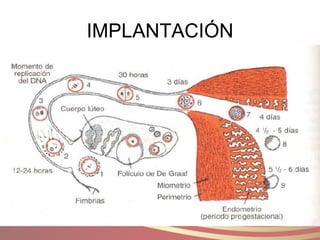 IMPLANTACIÓN 