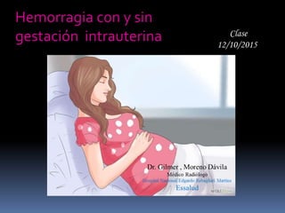 Hemorragia con y sin
gestación intrauterina Clase
12/10/2015
 