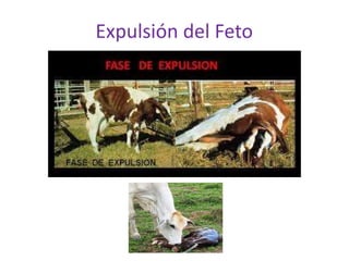 Expulsión del Feto
 