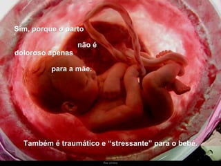 Ria slides Sim, porque o parto  não é doloroso apenas  para a mãe.   Também é traumático e “stressante” para o bebé. 