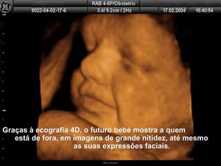 Ria slides Graças à ecografia 4D, o futuro bebé mostra a quem  está de fora, em imagens de grande nitidez, até mesmo  as suas expressões faciais. 