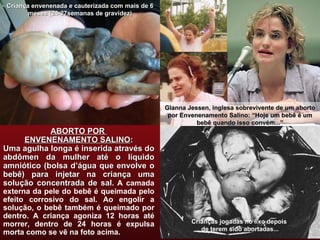 Gianna Jessen, inglesa sobrevivente de um aborto por Envenenamento Salino: “Hoje um bebê é um bebê quando isso convém...” ABORTO POR  ENVENENAMENTO SALINO : Uma agulha longa é inserida através do abdômen da mulher até o líquido amniótico (bolsa d’água que envolve o bebê) para injetar na criança uma solução concentrada de sal . A camada externa da pele do bebê é queimada pelo efeito corrosivo do sal. Ao engolir a solução, o bebê também é queimado por dentro. A criança agoniza 12 horas até morrer, dentro de 24 horas é expulsa morta como se vê na foto acima. Crianças jogadas no lixo depois  de terem sido abortadas... Criança envenenada e cauterizada com mais de 6 meses (24-27semanas de gravidez) 