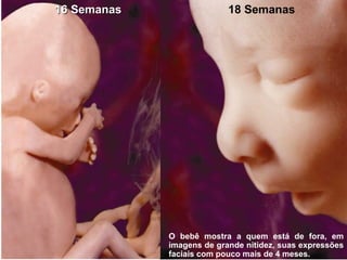 16 Semanas 18 Semanas O bebê mostra a quem está de fora, em imagens de grande nitidez, suas expressões faciais com pouco mais de 4 meses.  