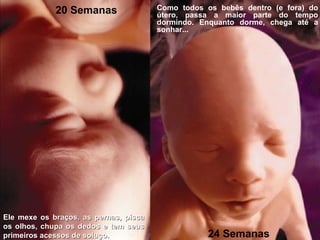 20 Semanas 24 Semanas Como todos os bebês dentro (e fora) do útero, passa a maior parte do tempo dormindo. Enquanto dorme, chega até a sonhar... Ele mexe os braços, as pernas, pisca os olhos, chupa os dedos e tem seus primeiros acessos de soluço. 
