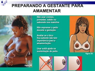PREPARANDO A GESTANTE PARA AMAMENTAR   