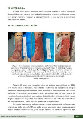 Gestão de Serviços de Enfermagem 2 Capítulo 15 152
2 | METODOLOGIA
Trata-se de um estudo descritivo, do tipo relato de experiência, acerca do cuidado
desenvolvido em um paciente com lesão pós-cirúrgica de cirurgia ortopédica que evoluiu
com comprometimento vascular, o acompanhamento se deu durante o atendimento
ambulatorial do mesmo.
3 | RESULTADOS E DISCUSSÕES
A Figura 1 demonstra os aspectos visuais do caso de forma significativos do ponto de vista
da evolução clínica do processo de cicatrização, incluindo formação do tecido de granulação,
presença de exsudato e borda da lesão. No dia 0 é possível perceber uma ferida extensa, com
muita fibrina, tecido esfacelado, bordas maceradas. No 15º dia é possível perceber que não há
mais fibrina, e que o tecido de granulação já está bem definido. Já no 60º a ferida apresenta
uma regressão de sua extensão e já inicia o processo de reepitelização.
Fonte: acervo pessoal.
Paciente 59 anos, sexo masculino, vítima de acidente automobilístico em 2000,
com fratura grave no tornozelo. Hospitalizado e submetido ao procedimento cirúrgico
ortopédico, com inserção de síntese de titânio parafusos de órtese e prótese, para fixação
da fratura. Em virtude de complicações na lesão, foi diagnosticado com trombose e úlcera
vasculogênica, comprometendo todo processo de cicatrização e principalmente no traçado
do plano assistencial terapêutico. Paciente foi referenciado ao centro de tratamento de
feridas para avaliação, sendo atendido pela equipe multiprofissional.
Ao iniciar o tratamento a lesão apresentava grande quantidade de biofilme em toda
extensão da lesão, exsudato 75% da lesão, grande quantidade tecido esfacelado; como
medida imediata intervencionista, para reduzir biofilme, foi realizadas aplicações com
 