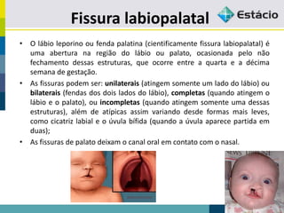 Fissura labiopalatal
• O lábio leporino ou fenda palatina (cientificamente fissura labiopalatal) é
uma abertura na região do lábio ou palato, ocasionada pelo não
fechamento dessas estruturas, que ocorre entre a quarta e a décima
semana de gestação.
• As fissuras podem ser: unilaterais (atingem somente um lado do lábio) ou
bilaterais (fendas dos dois lados do lábio), completas (quando atingem o
lábio e o palato), ou incompletas (quando atingem somente uma dessas
estruturas), além de atípicas assim variando desde formas mais leves,
como cicatriz labial e o úvula bífida (quando a úvula aparece partida em
duas);
• As fissuras de palato deixam o canal oral em contato com o nasal.
 
