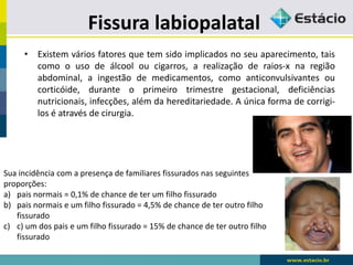 Fissura labiopalatal
• Existem vários fatores que tem sido implicados no seu aparecimento, tais
como o uso de álcool ou cigarros, a realização de raios-x na região
abdominal, a ingestão de medicamentos, como anticonvulsivantes ou
corticóide, durante o primeiro trimestre gestacional, deficiências
nutricionais, infecções, além da hereditariedade. A única forma de corrigi-
los é através de cirurgia.
Sua incidência com a presença de familiares fissurados nas seguintes
proporções:
a) pais normais = 0,1% de chance de ter um filho fissurado
b) pais normais e um filho fissurado = 4,5% de chance de ter outro filho
fissurado
c) c) um dos pais e um filho fissurado = 15% de chance de ter outro filho
fissurado
 
