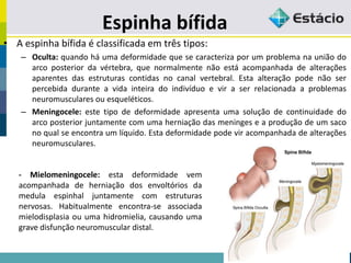 Espinha bífida
• A espinha bífida é classificada em três tipos:
– Oculta: quando há uma deformidade que se caracteriza por um problema na união do
arco posterior da vértebra, que normalmente não está acompanhada de alterações
aparentes das estruturas contidas no canal vertebral. Esta alteração pode não ser
percebida durante a vida inteira do indivíduo e vir a ser relacionada a problemas
neuromusculares ou esqueléticos.
– Meningocele: este tipo de deformidade apresenta uma solução de continuidade do
arco posterior juntamente com uma herniação das meninges e a produção de um saco
no qual se encontra um líquido. Esta deformidade pode vir acompanhada de alterações
neuromusculares.
- Mielomeningocele: esta deformidade vem
acompanhada de herniação dos envoltórios da
medula espinhal juntamente com estruturas
nervosas. Habitualmente encontra-se associada
mielodisplasia ou uma hidromielia, causando uma
grave disfunção neuromuscular distal.
 