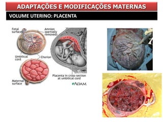 ADAPTAÇÕES E MODIFICAÇÕES MATERNAS
VOLUME UTERINO: PLACENTA
 