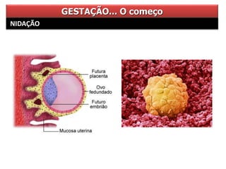 GESTAÇÃO... O começo
NIDAÇÃO
 