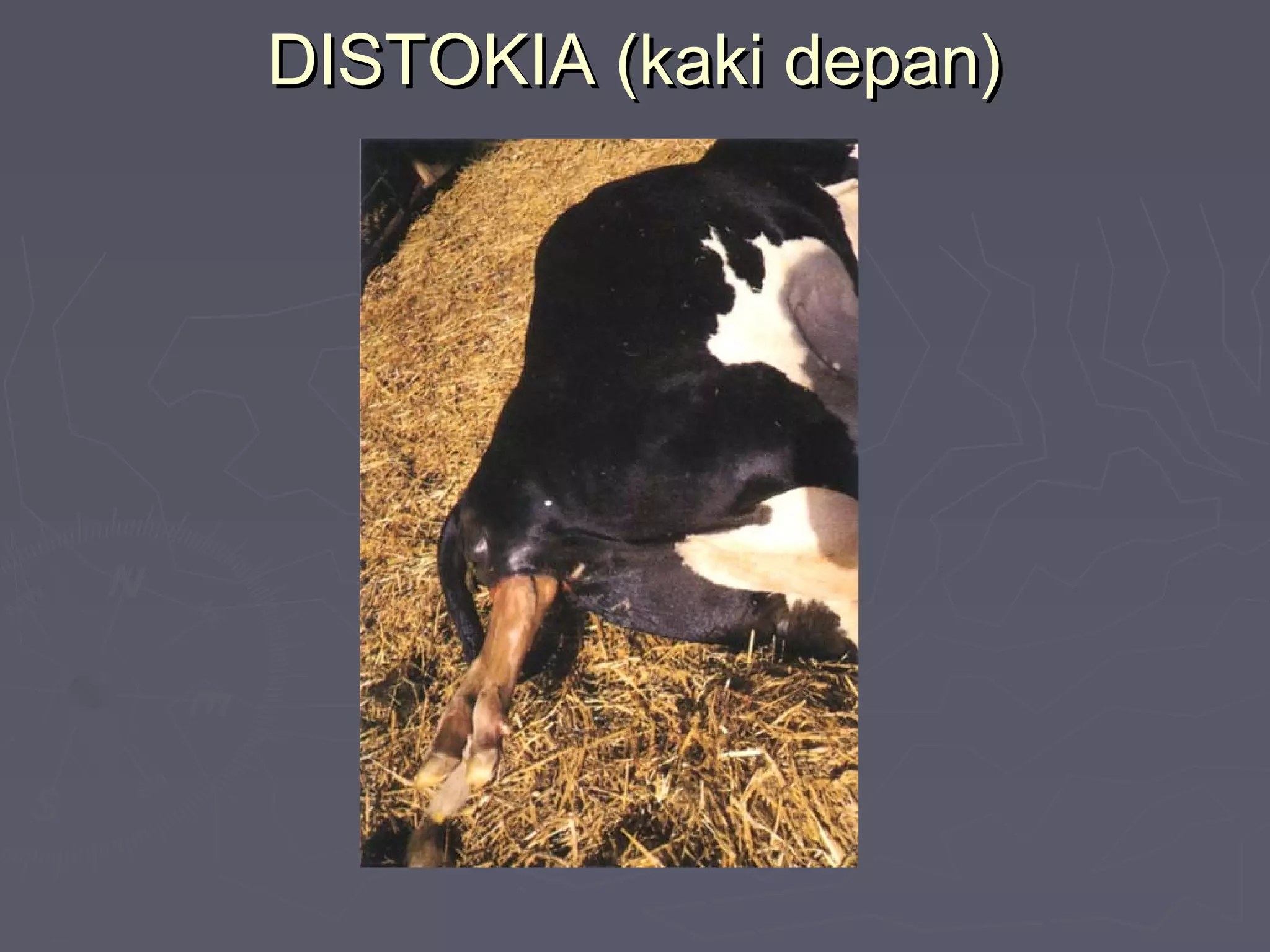DISTOKIA (kaki depan)DISTOKIA (kaki depan)
 