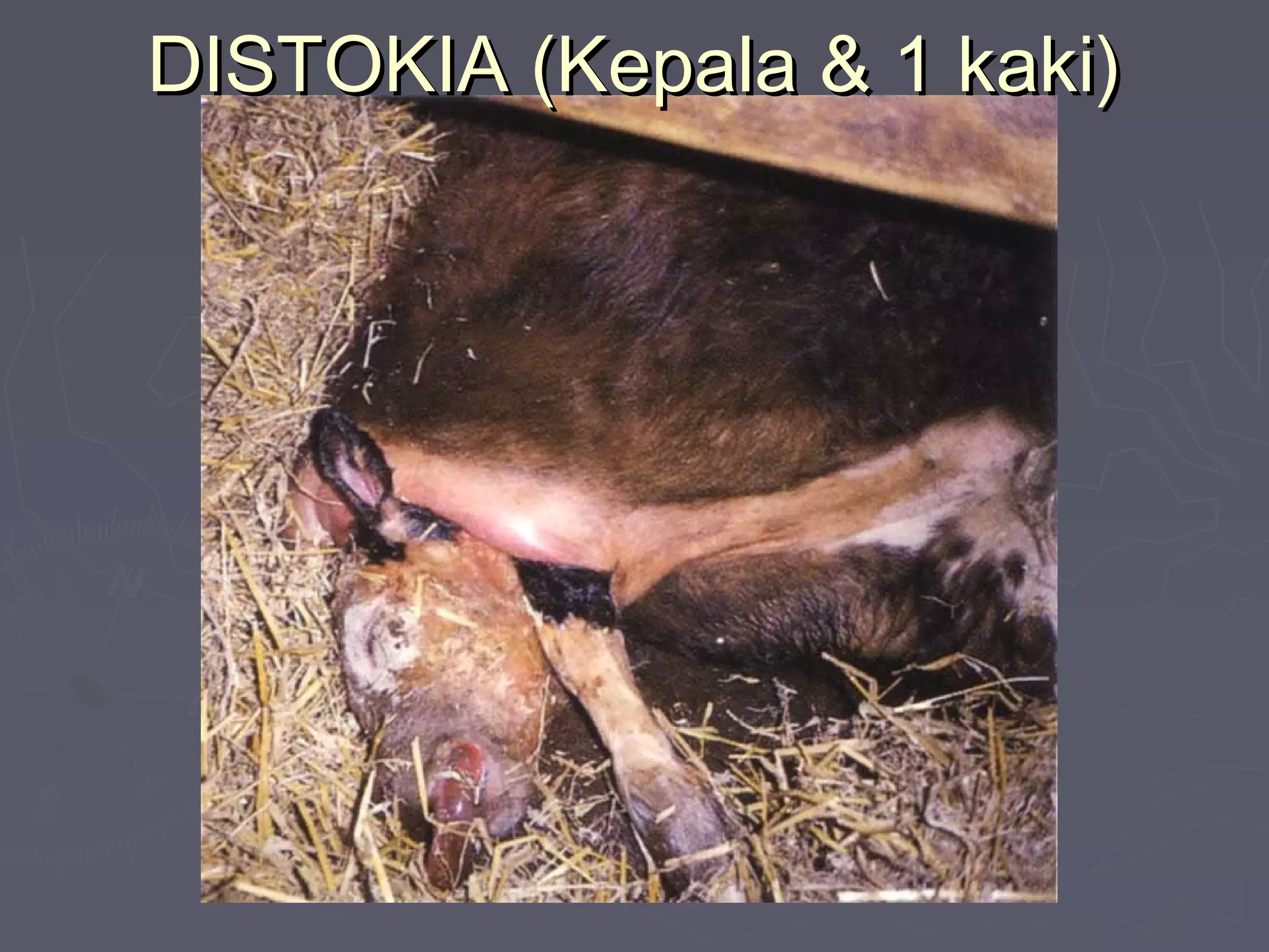 DISTOKIA (Kepala & 1 kaki)DISTOKIA (Kepala & 1 kaki)
 
