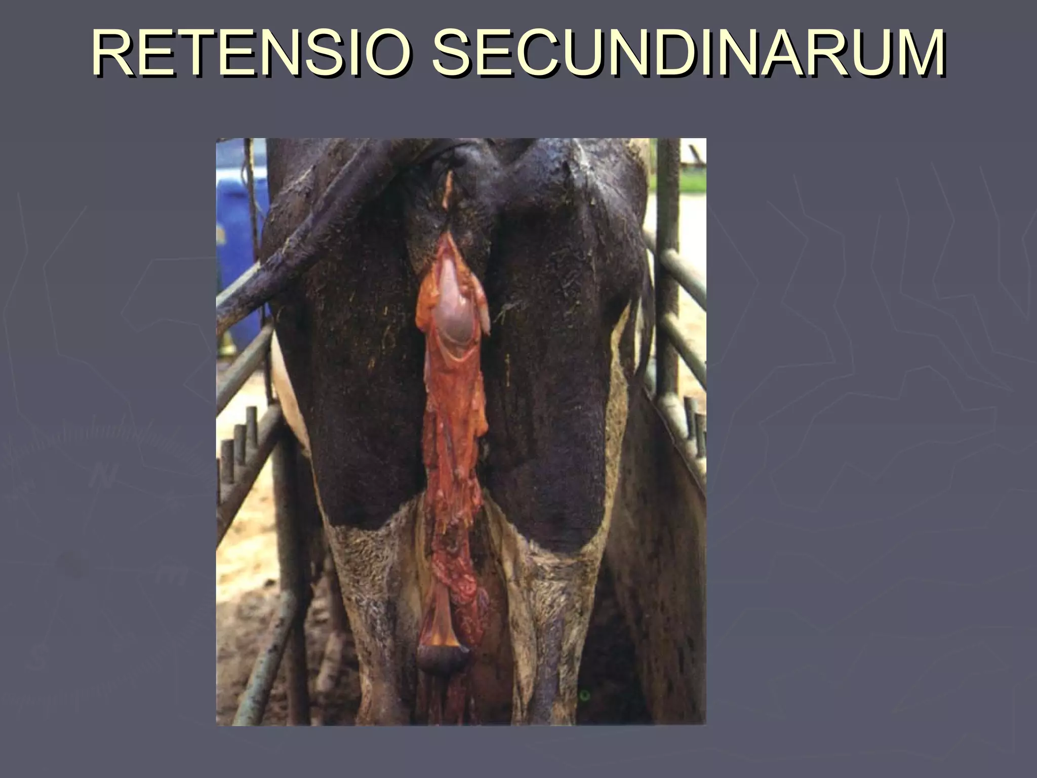 RETENSIO SECUNDINARUMRETENSIO SECUNDINARUM
 